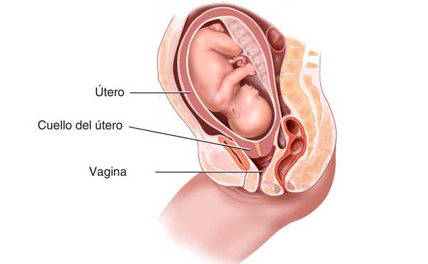 maniobra de hamilton para que se reliza
