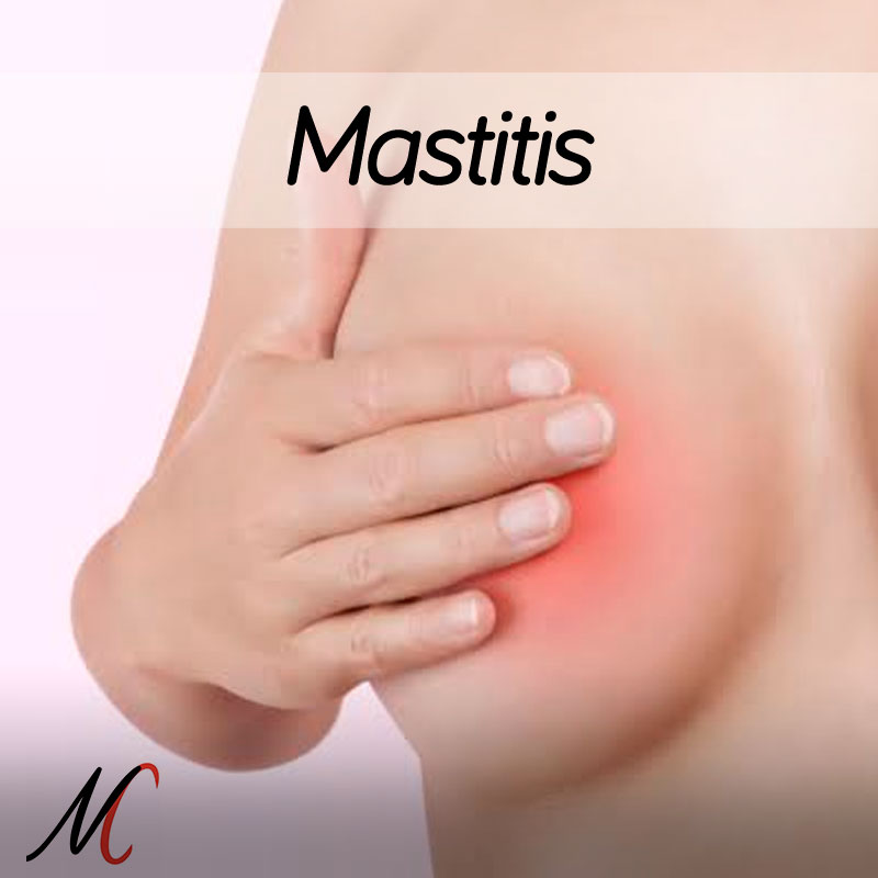 mastitis
