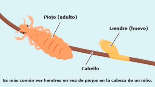 dibujo como se quitan los piojos